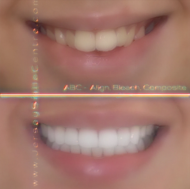 Smile Img