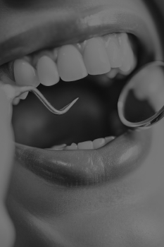 treatment img