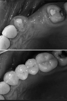 treatment img