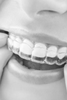 treatment img
