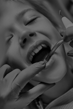 treatment img